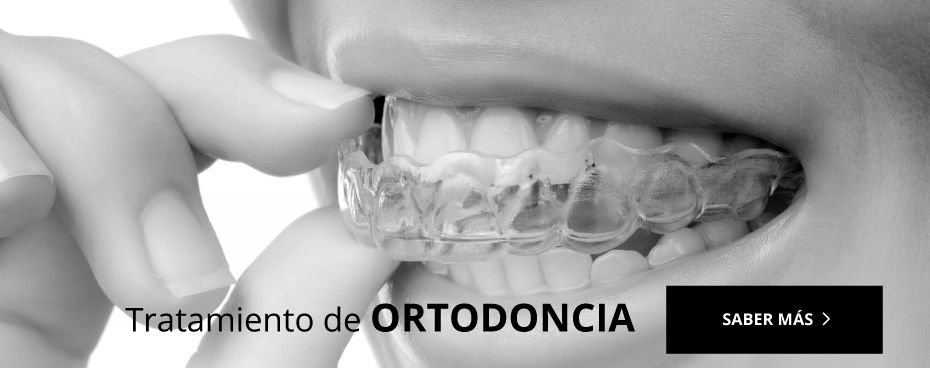 ortodoncia loeches