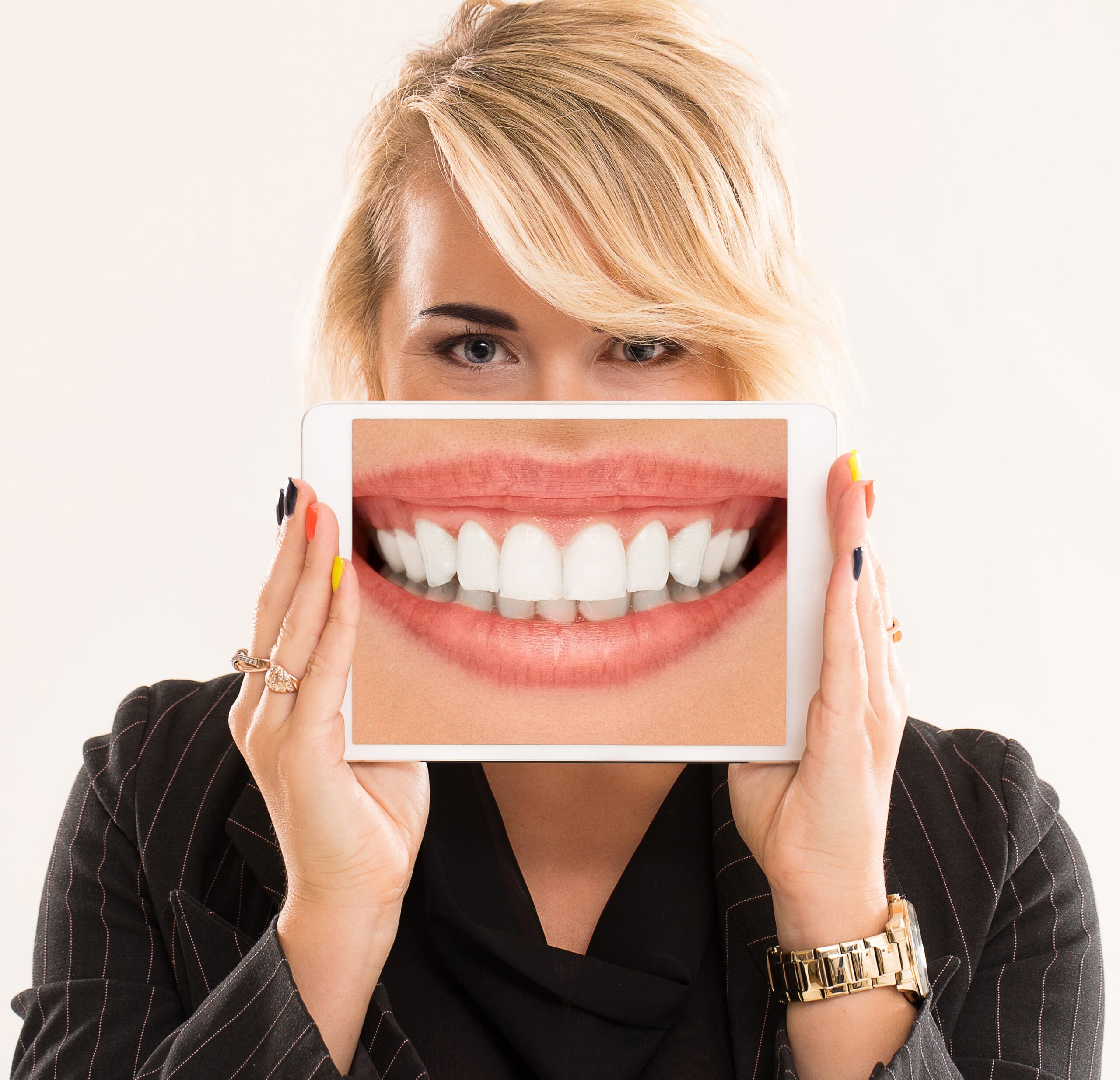 ¿Qué ocurre después de terminar el tratamiento de ortodoncia?